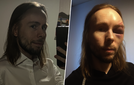 Rauli, 36, luuli tapelleensa yöllä – Totuus oli paljon pahempi